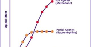 Drug Addiction and the Case for Medication-Assisted Treatment – vnews.com Drug Addiction and the Case for Medication-Assisted Treatment