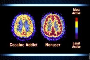 The Way We Talk About Drug Abuse Is Harmful