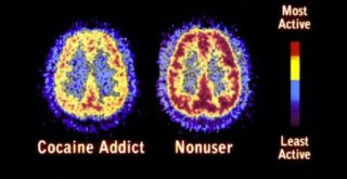 The Way We Talk About Drug Abuse Is Harmful – Huffington Post The Way We Talk About Drug Abuse Is Harmful